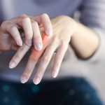 Meski kondisi ini tak dapat disembuhkan total, namun kualitas hidup tetap bisa dijaga dengan baik melalui kombinasi pengobatan, olahraga, pola makan sehat, serta dukungan emosional.